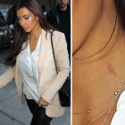  Kim Kardashian Has an Itch or a Bruise