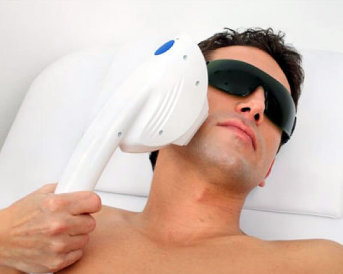 Laser Treatments