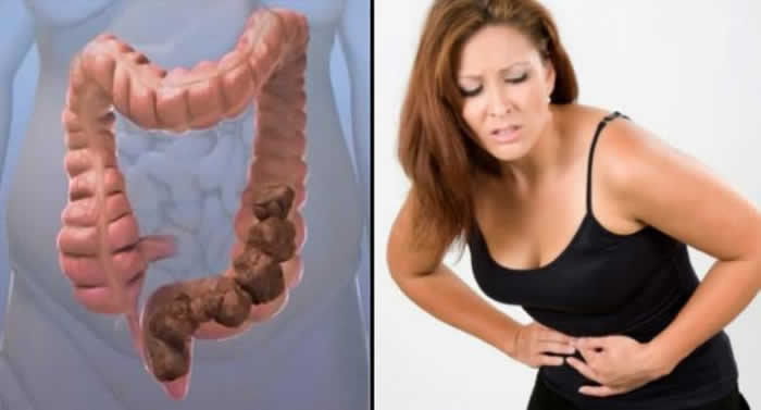 12 Surprising Reasons You're Constipated