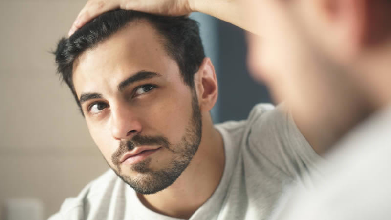  Ways to Fix the Issue of Receding Hairline