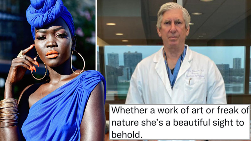  Columbia University’s Psychiatrist Suspended After Calling Black Model “A Freak Of Nature”