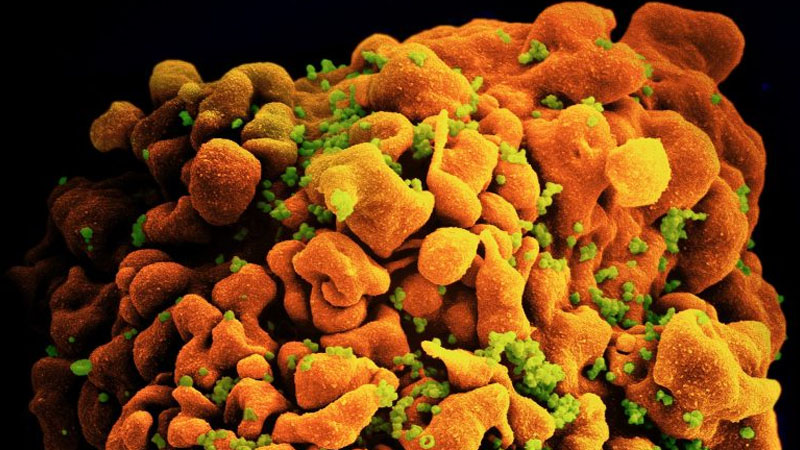  New “Highly Virulent” Strain Of HIV Discovered In The Netherlands