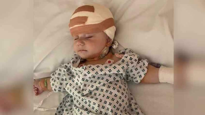  A baby Born with a Rare Condition Needed life-Saving Surgery