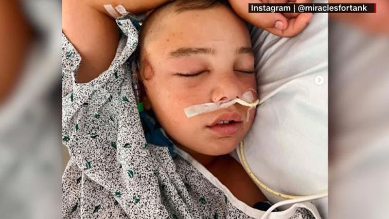  Injured Little Leaguer’s face swelling has increased, limiting his vision: Doctor