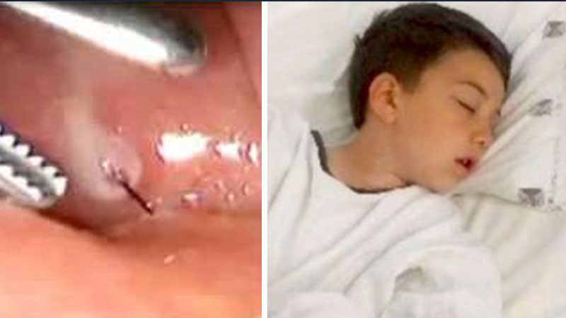  Little Boy Almost Dies After Eating Food Doctors Issue Warning About Avoidable treatment