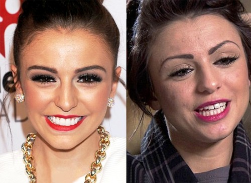 Cher Lloyd's