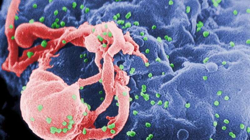  30-Year-Old Woman Whose HIV Vanished Gives Hope For AIDS Cure