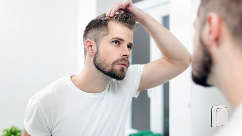  How to Look Great Despite Hair Loss: Hairstyle Ideas for Balding Men