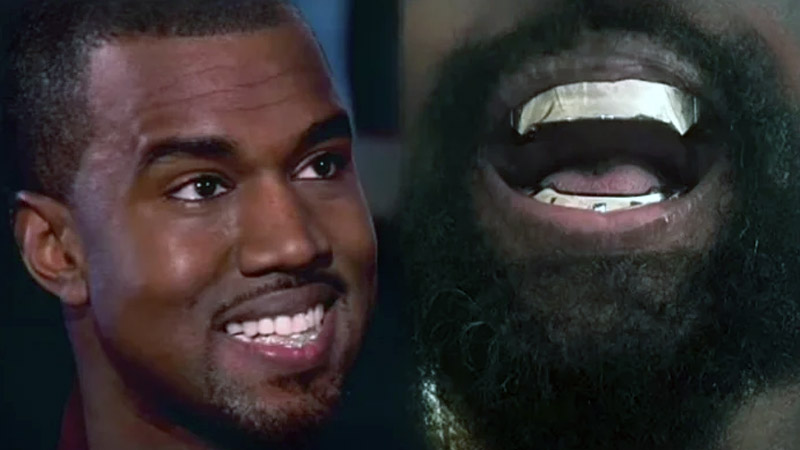  ‘Expensive than Diamonds’ Kanye West makes ‘bold’ move by having all teeth REMOVED
