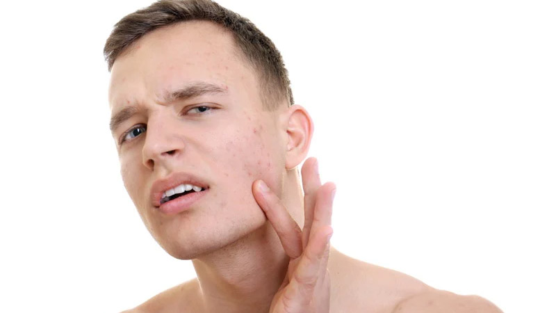 Popping Pimples